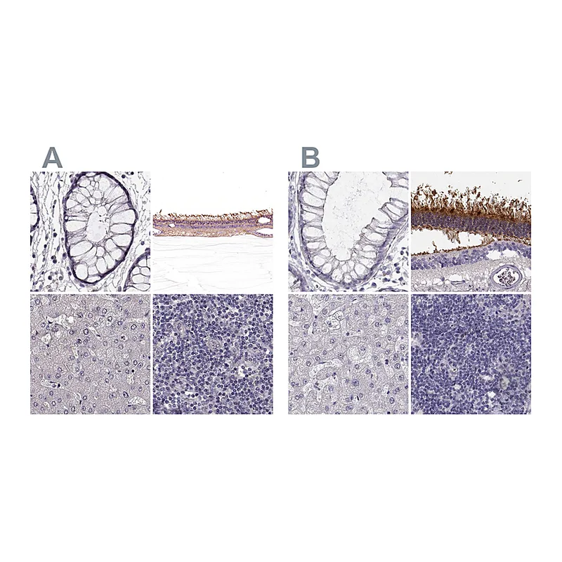 Atlas Antibodies Anti-GRK1 Antibody