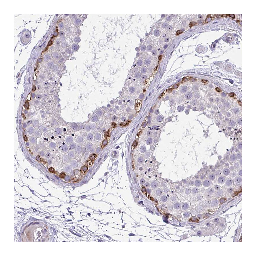 Atlas Antibodies Anti-GRK4 Antibody