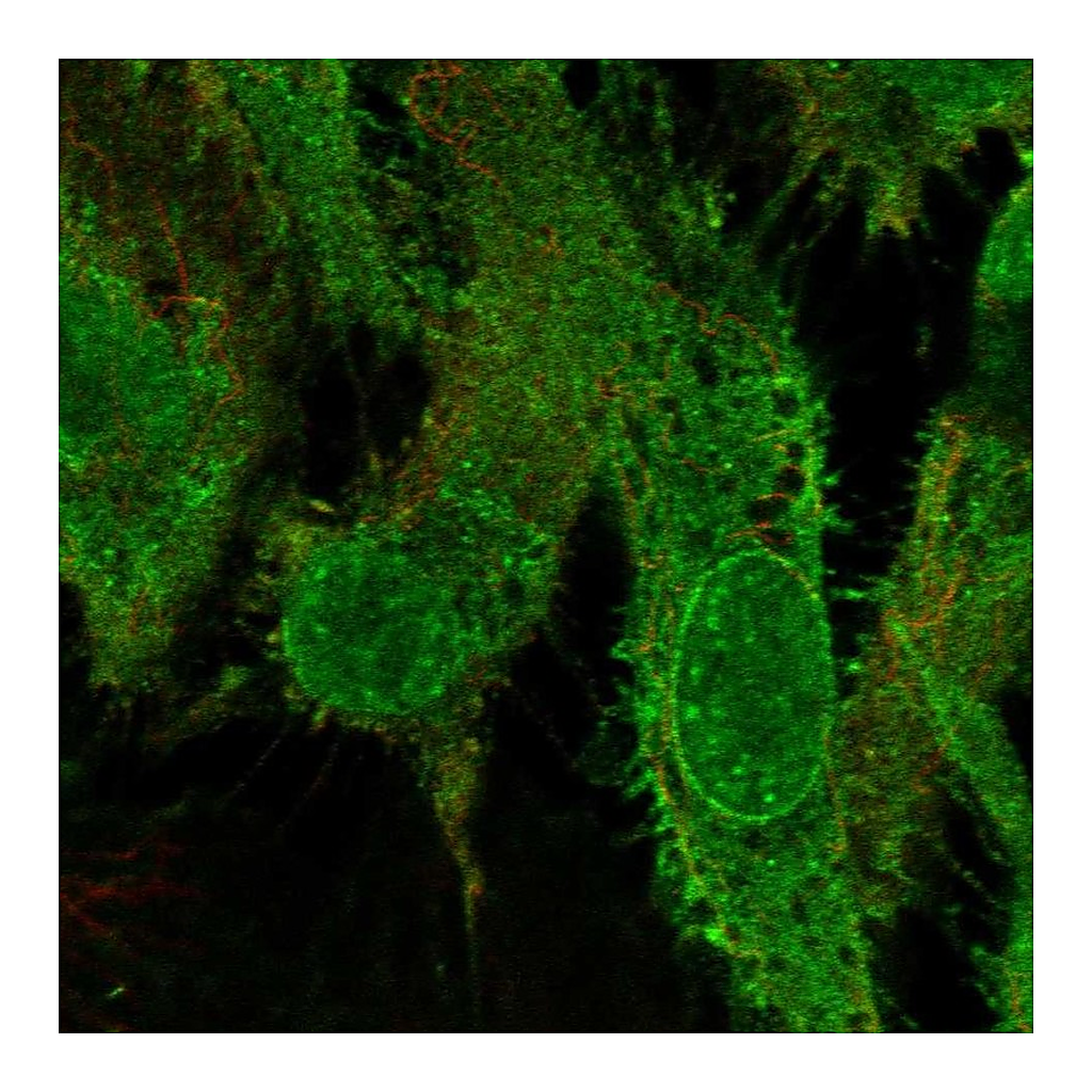 Atlas Antibodies Anti-GRK5 Antibody