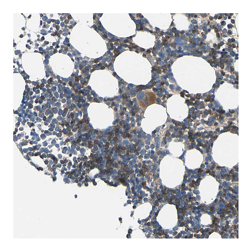Atlas Antibodies Anti-GRK6 Antibody