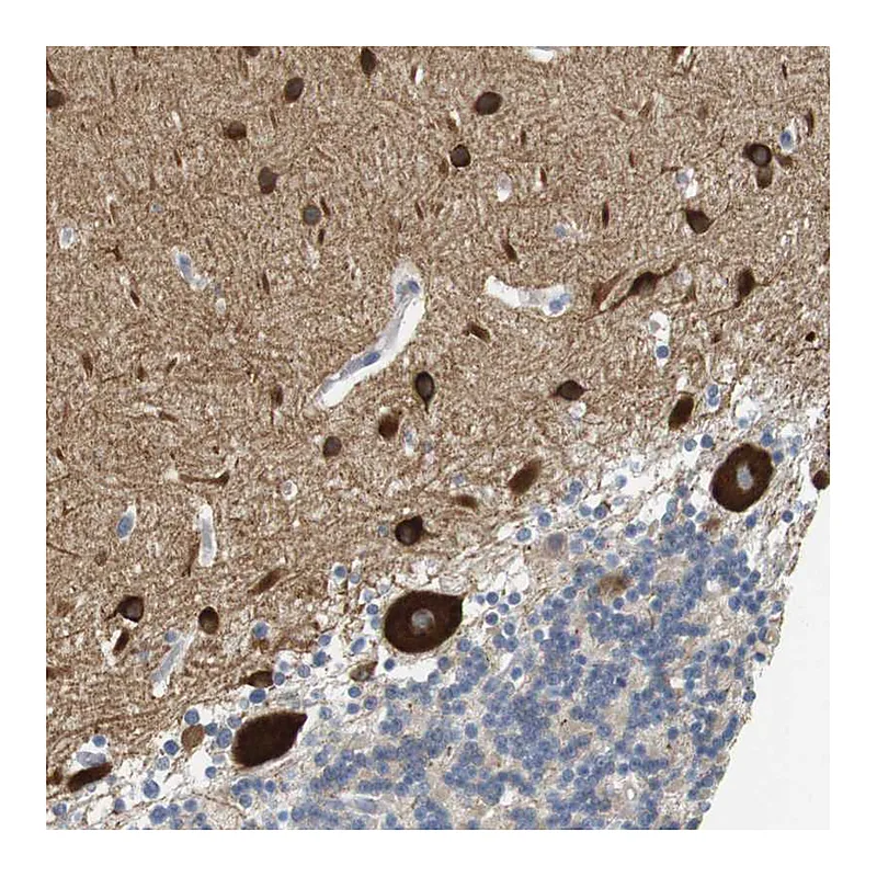 Atlas Antibodies Anti-GRM1 Antibody