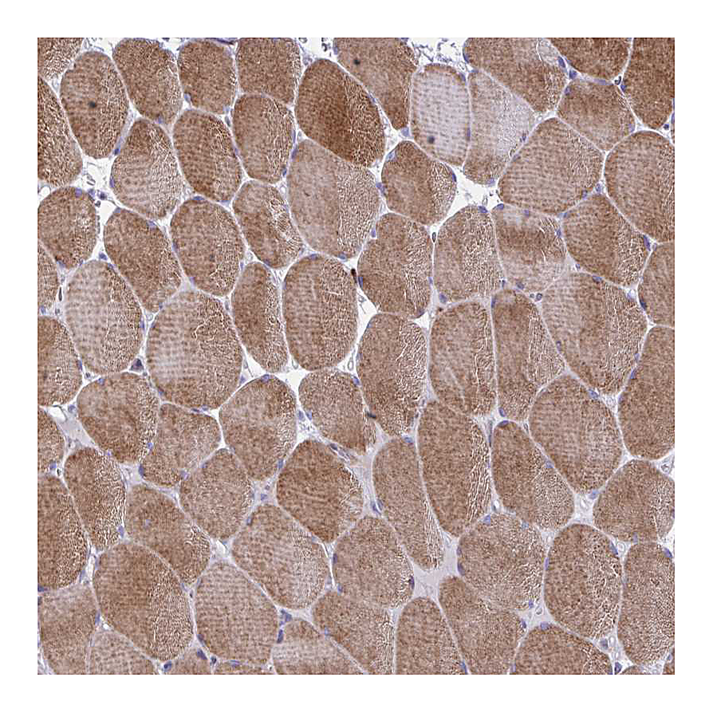 Atlas Antibodies Anti-GRXCR2 Antibody