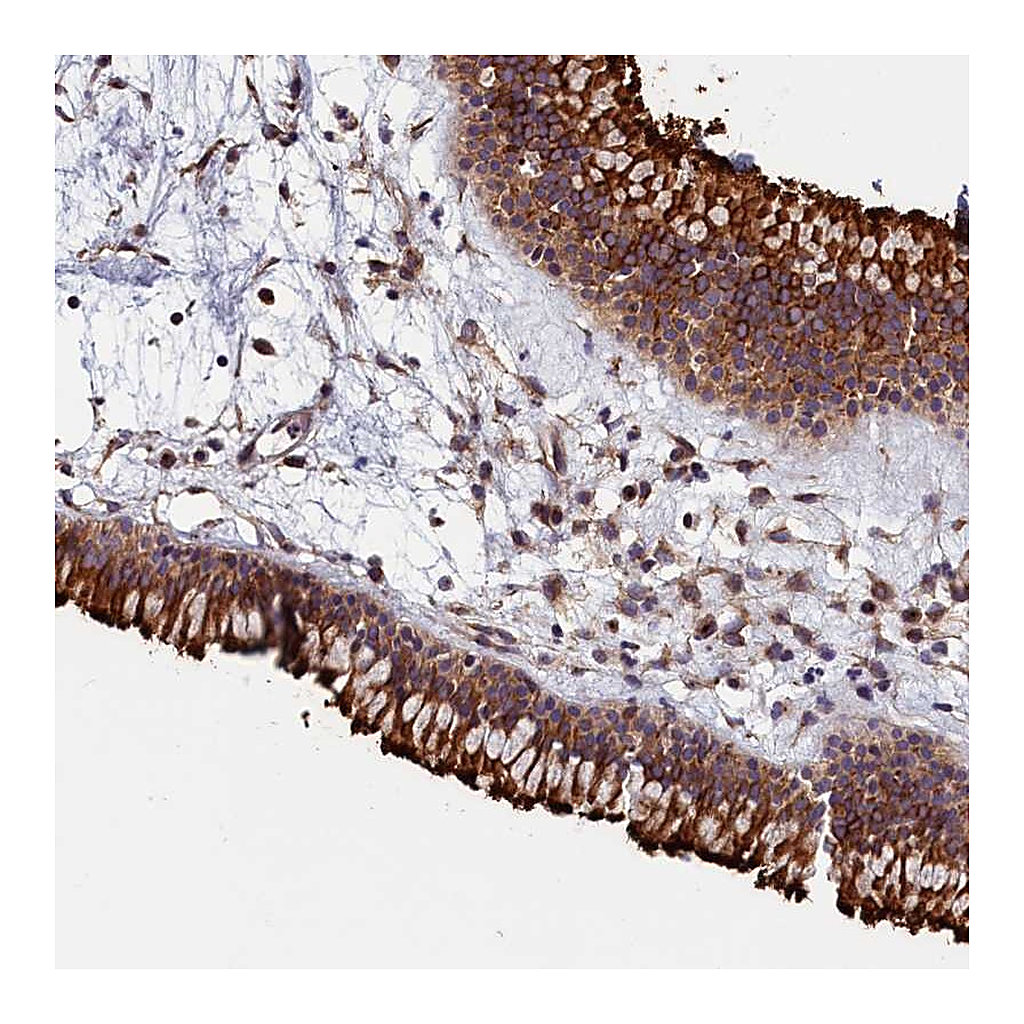 Atlas Antibodies Anti-GRXCR1 Antibody