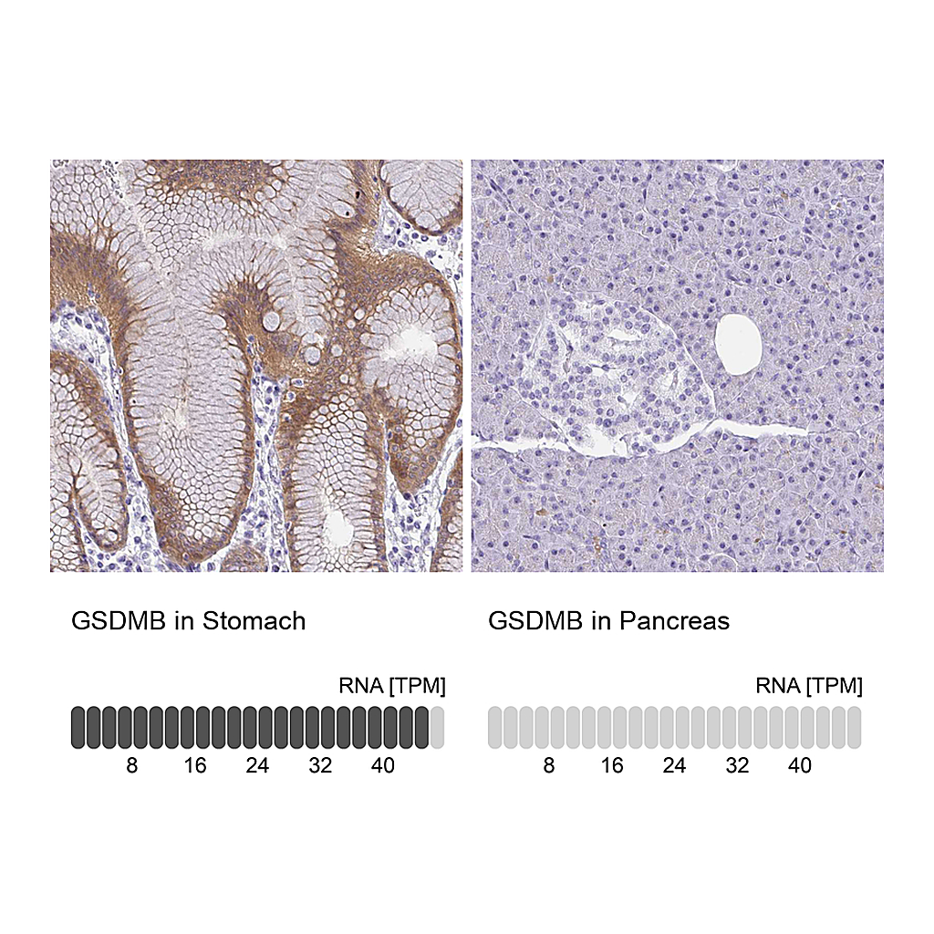 Atlas Antibodies Anti-GSDMB Antibody