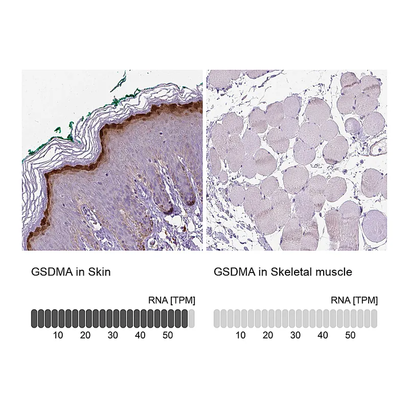 Atlas Antibodies Anti-GSDMA Antibody
