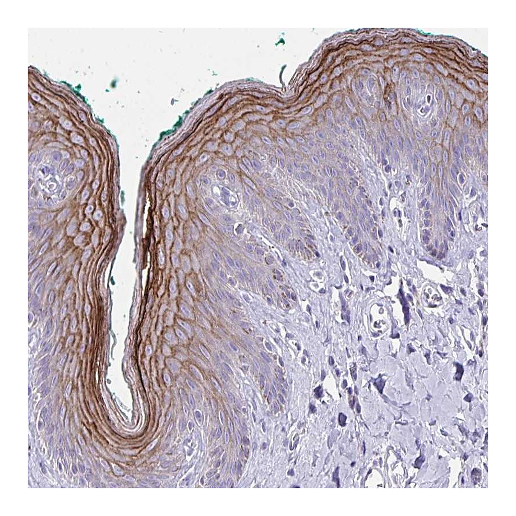Atlas Antibodies Anti-GSG1L2 Antibody