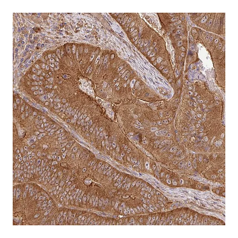 Atlas Antibodies Anti-GSPT1 Antibody