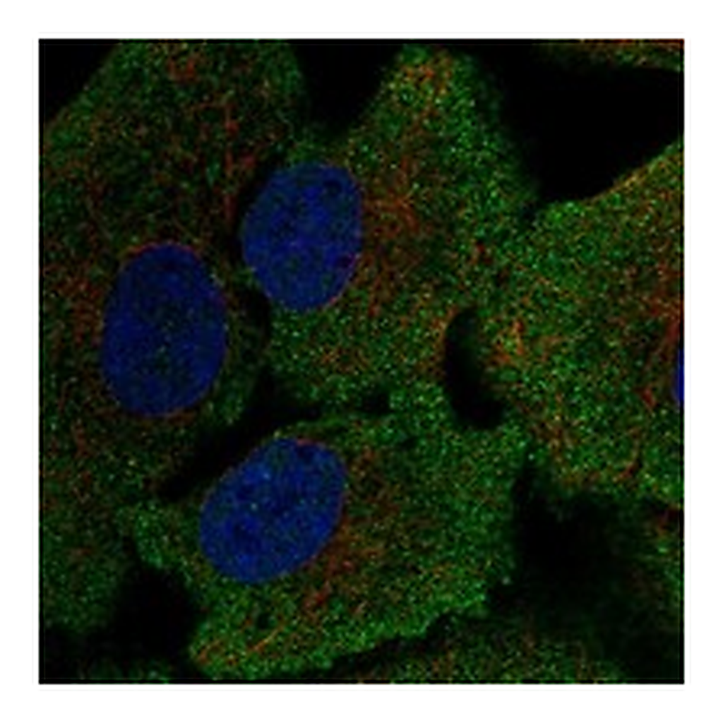 Atlas Antibodies Anti-GSR Antibody