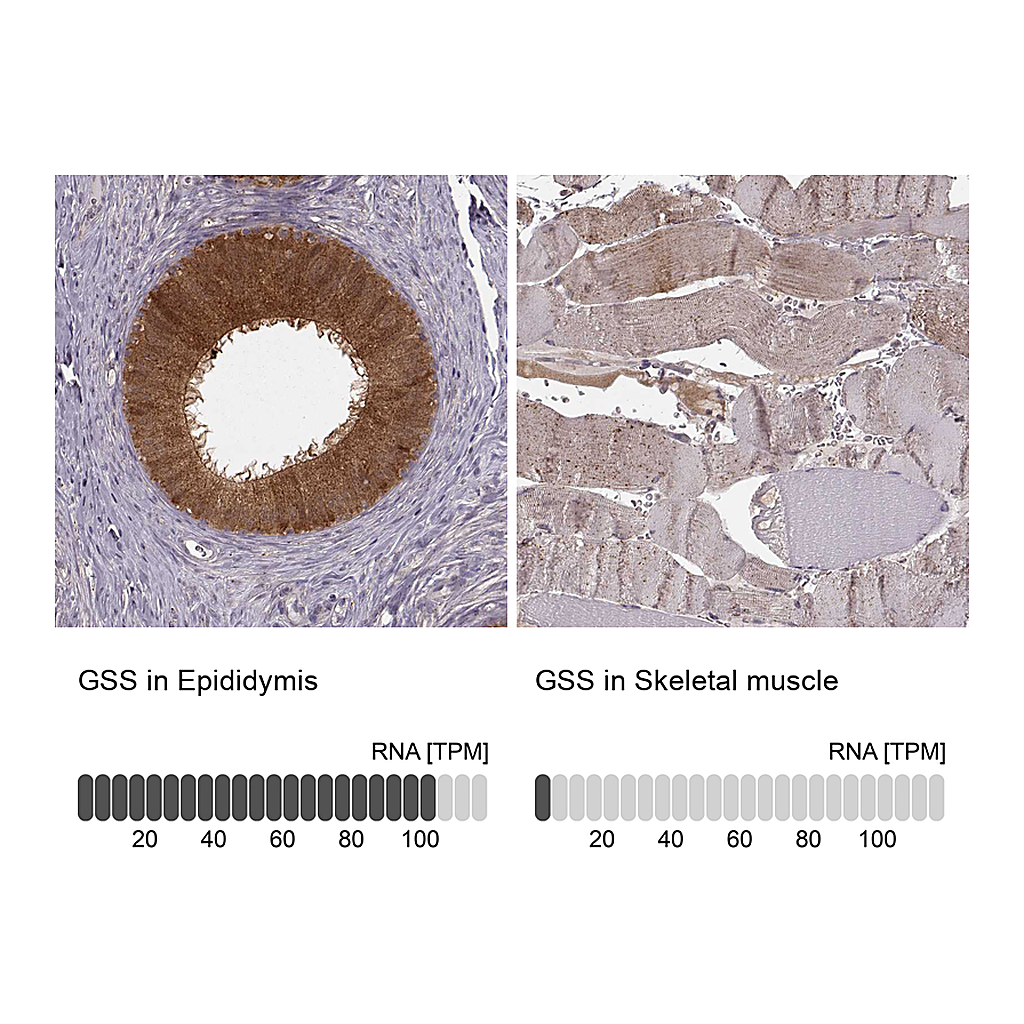 Atlas Antibodies Anti-GSS Antibody