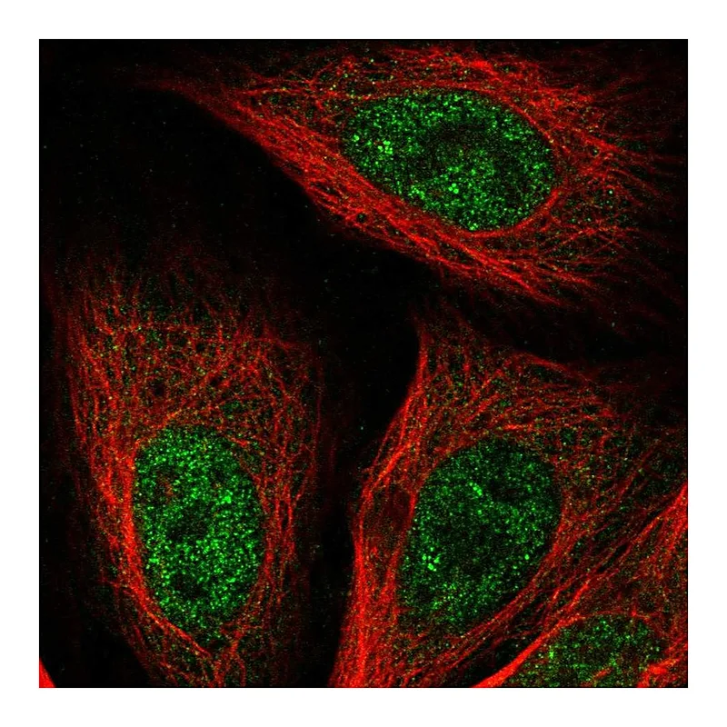 Atlas Antibodies Anti-GSTCD Antibody
