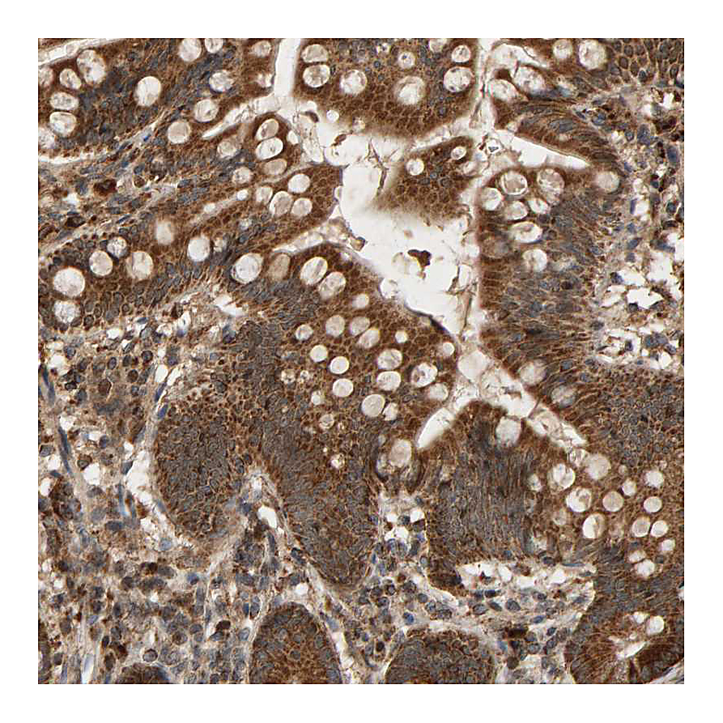Atlas Antibodies Anti-GSTK1 Antibody