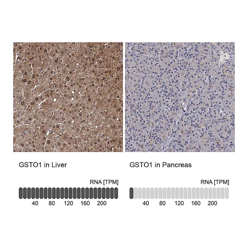 Atlas Antibodies Anti-GSTO1 Antibody