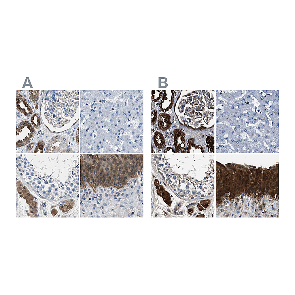 Atlas Antibodies Anti-GSTP1 Antibody