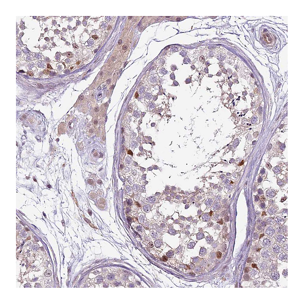 Atlas Antibodies Anti-GSTO2 Antibody