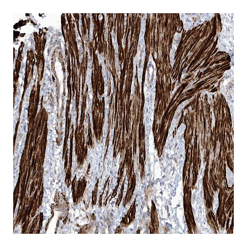 Atlas Antibodies Anti-GTDC1 Antibody