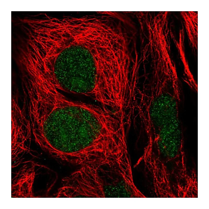 Atlas Antibodies Anti-GTF2E1 Antibody