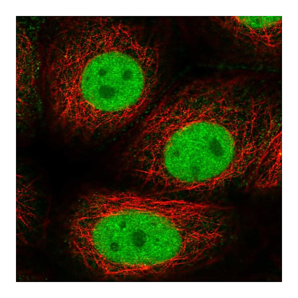 Atlas Antibodies Anti-GTF2F1 Antibody