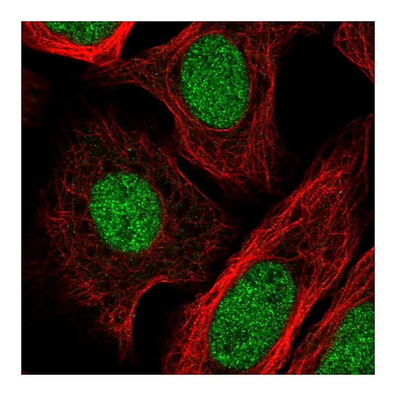 Atlas Antibodies Anti-GTF2IRD2B Antibody