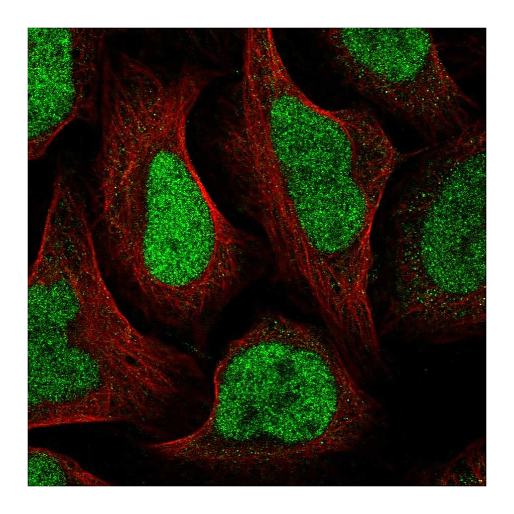 Atlas Antibodies Anti-GTF2IRD2B Antibody