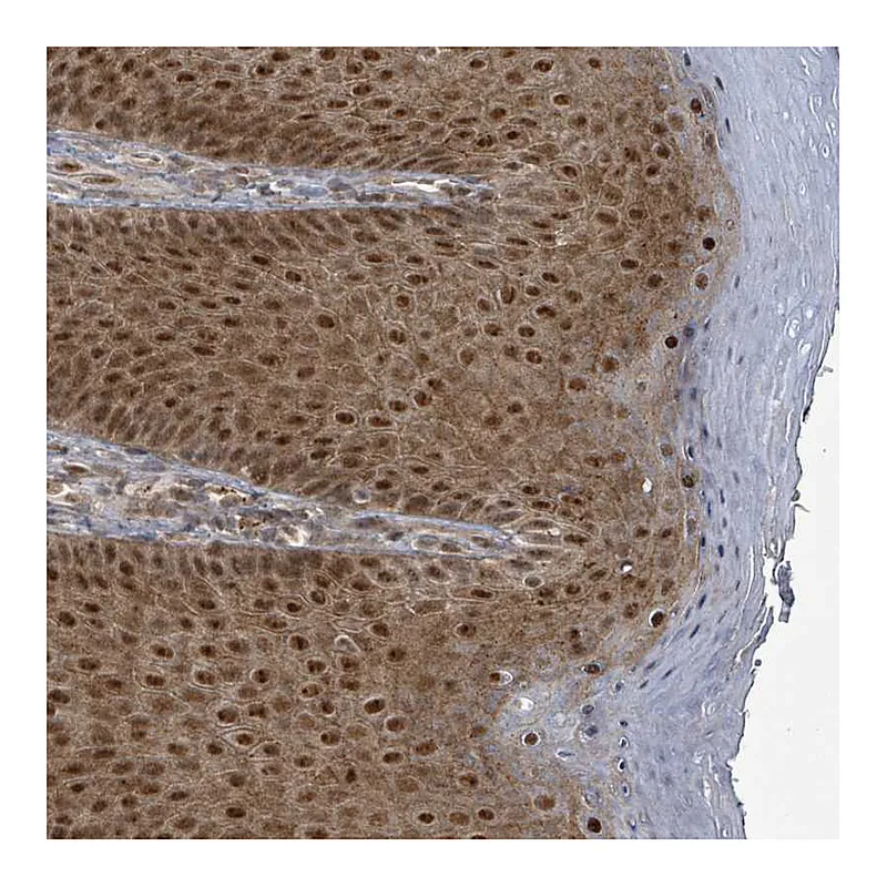 Atlas Antibodies Anti-GTF3C1 Antibody