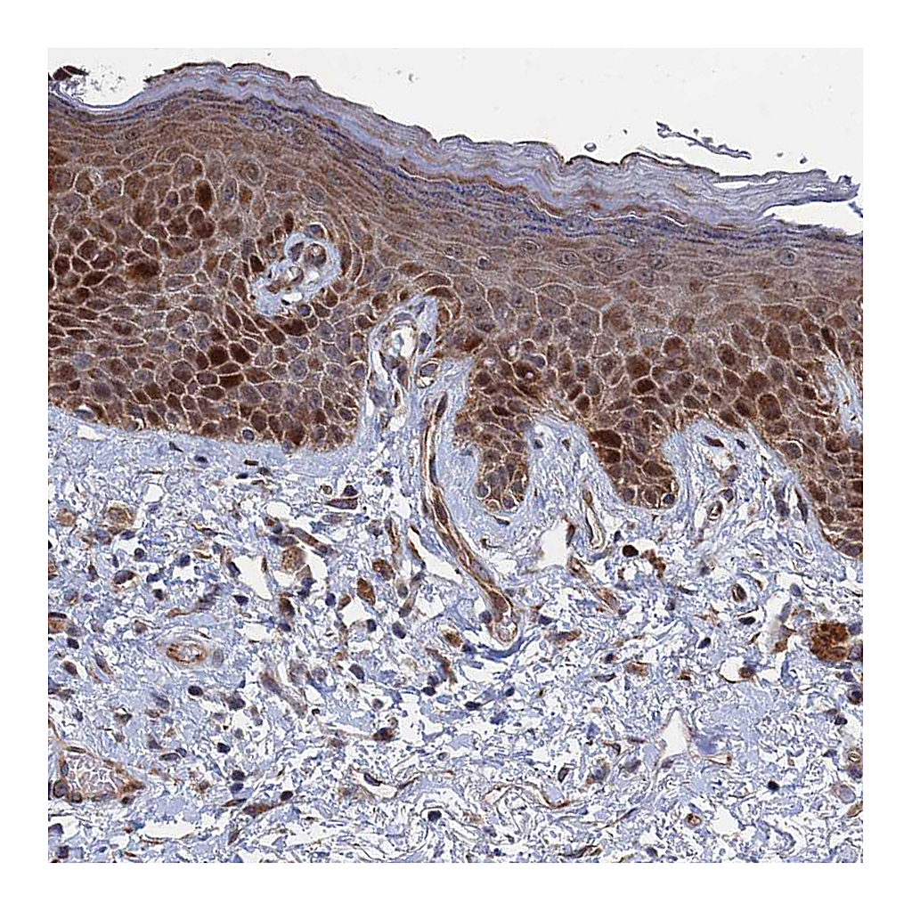 Atlas Antibodies Anti-GTF2IRD1 Antibody