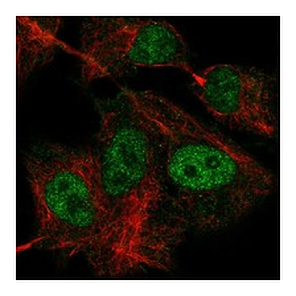 Atlas Antibodies Anti-GTF3C1 Antibody