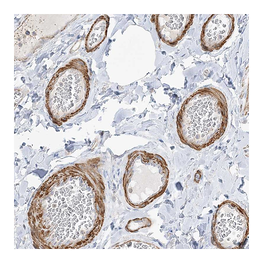 Atlas Antibodies Anti-GTF3C2 Antibody