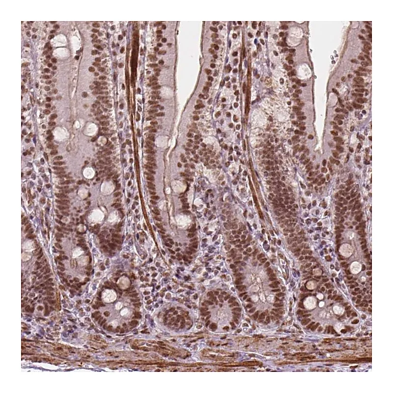 Atlas Antibodies Anti-GTF3C5 Antibody