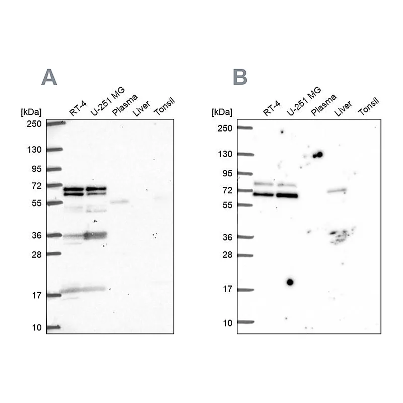Atlas Antibodies Anti-GTF3C5 Antibody