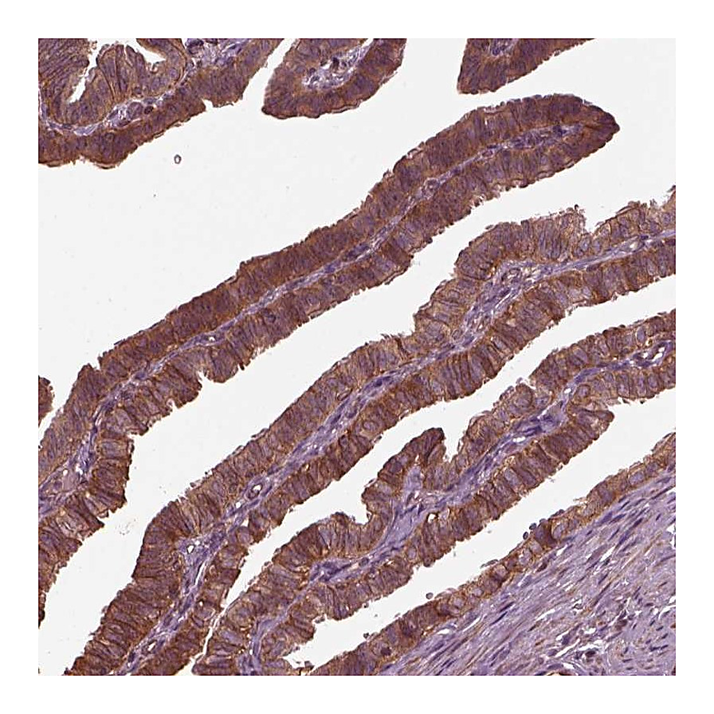 Atlas Antibodies Anti-GTPBP1 Antibody