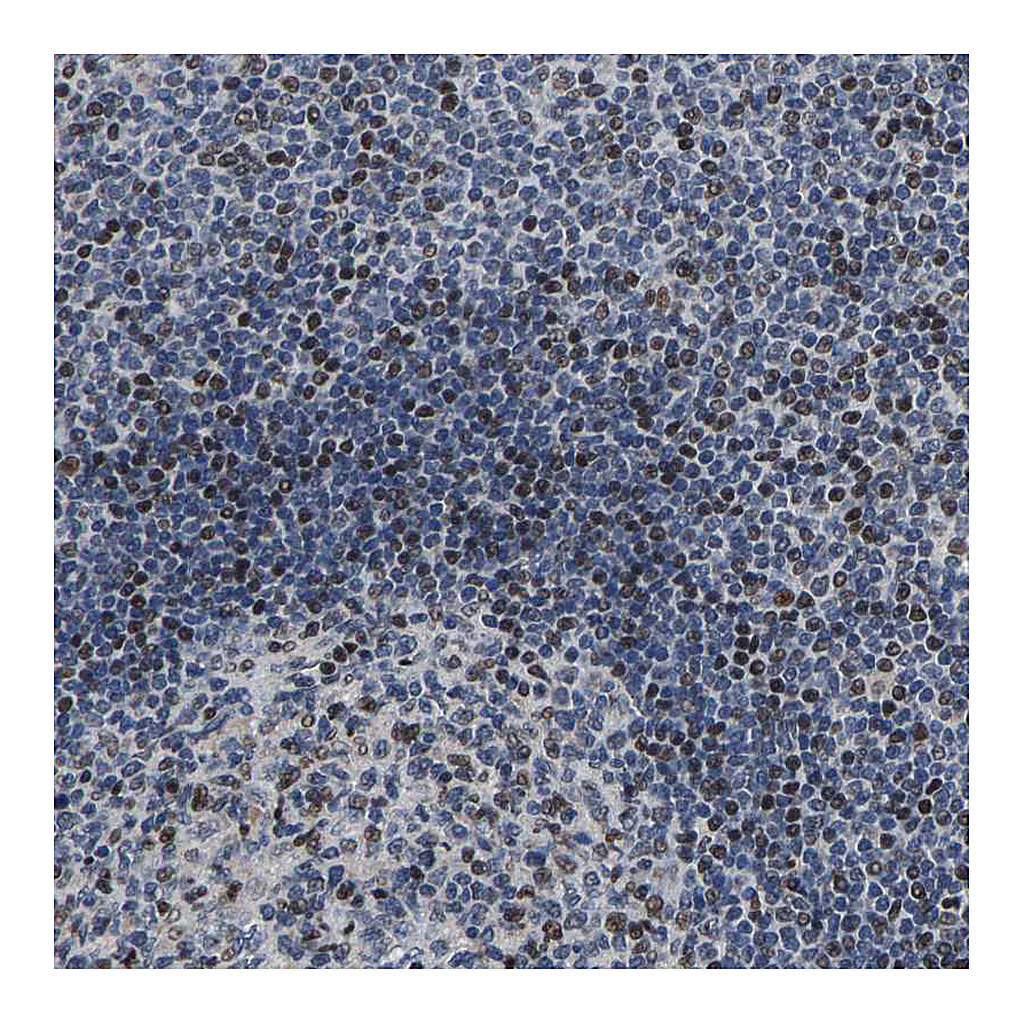 Atlas Antibodies Anti-GTPBP10 Antibody