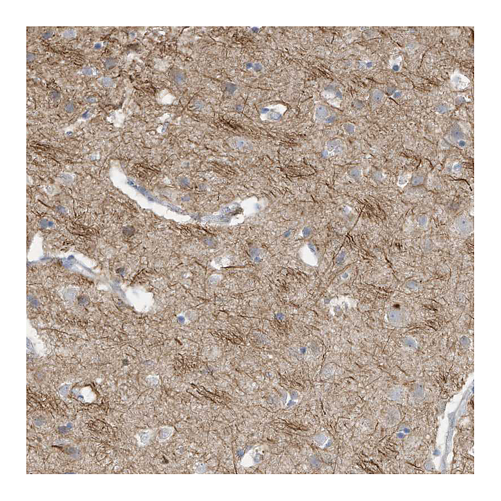 Atlas Antibodies Anti-GTPBP2 Antibody