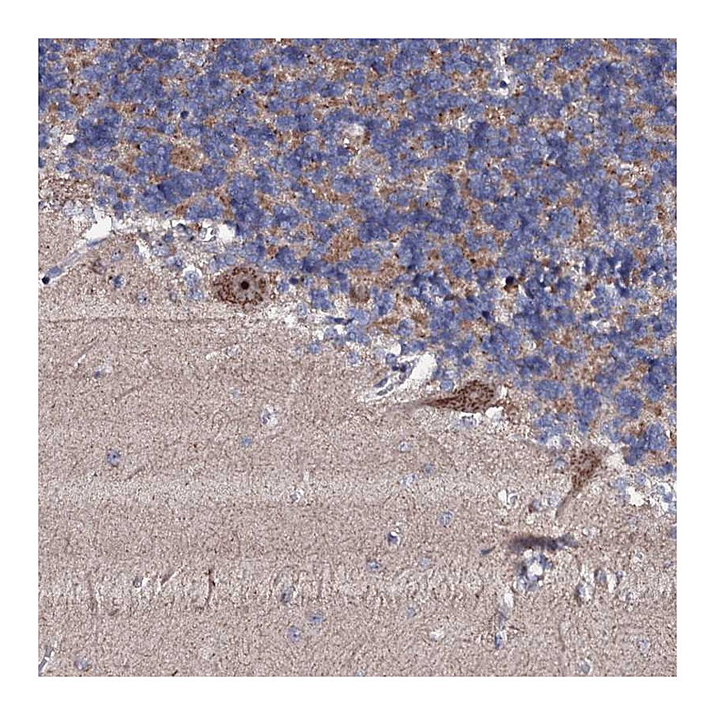 Atlas Antibodies Anti-GTPBP4 Antibody