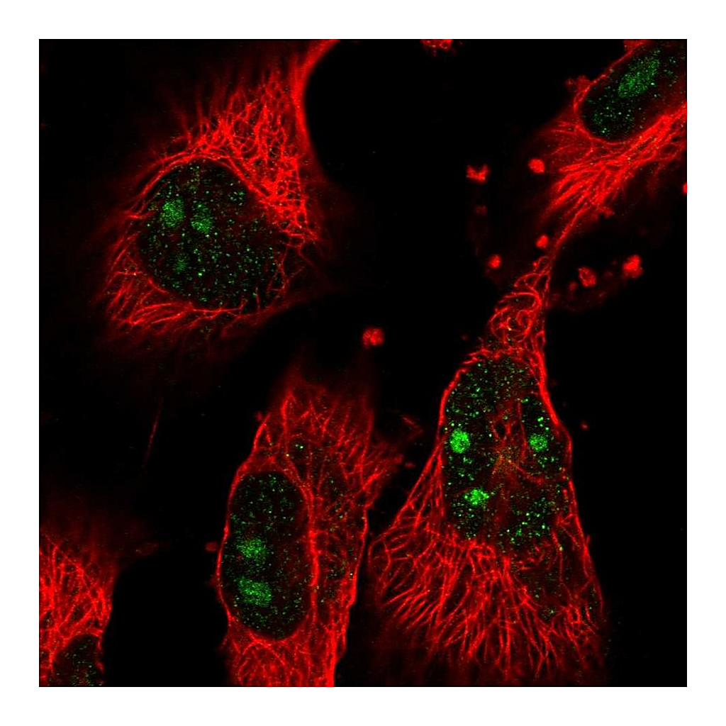 Atlas Antibodies Anti-GTPBP4 Antibody