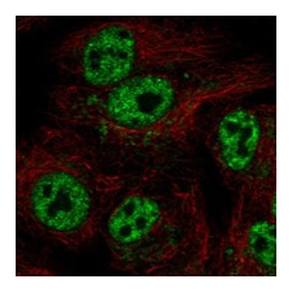 Atlas Antibodies Anti-GTPBP6 Antibody