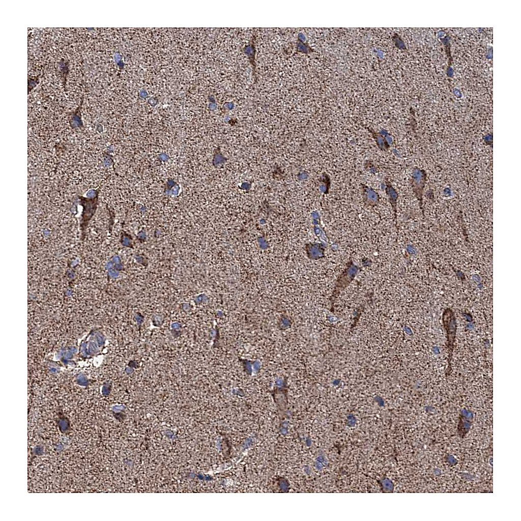 Atlas Antibodies Anti-GTPBP3 Antibody