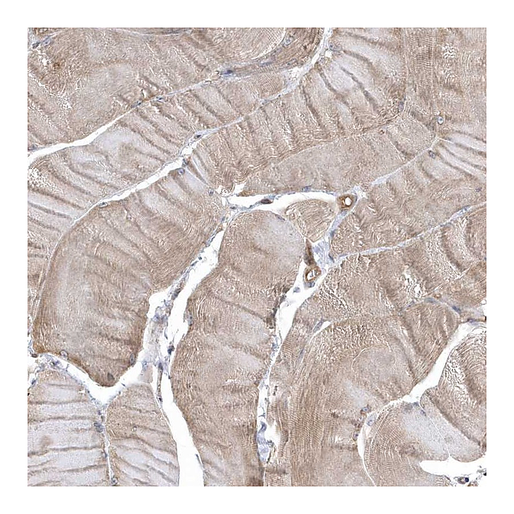Atlas Antibodies Anti-GTPBP6 Antibody