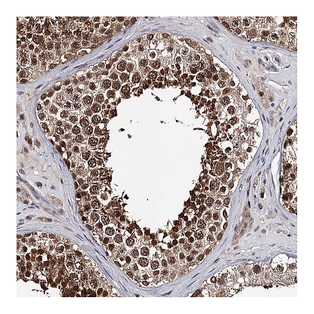Atlas Antibodies Anti-GTSF1 Antibody