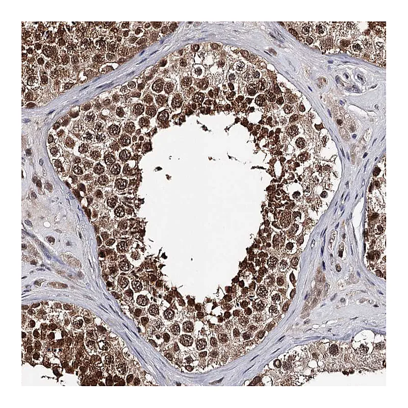 Atlas Antibodies Anti-GTSF1 Antibody