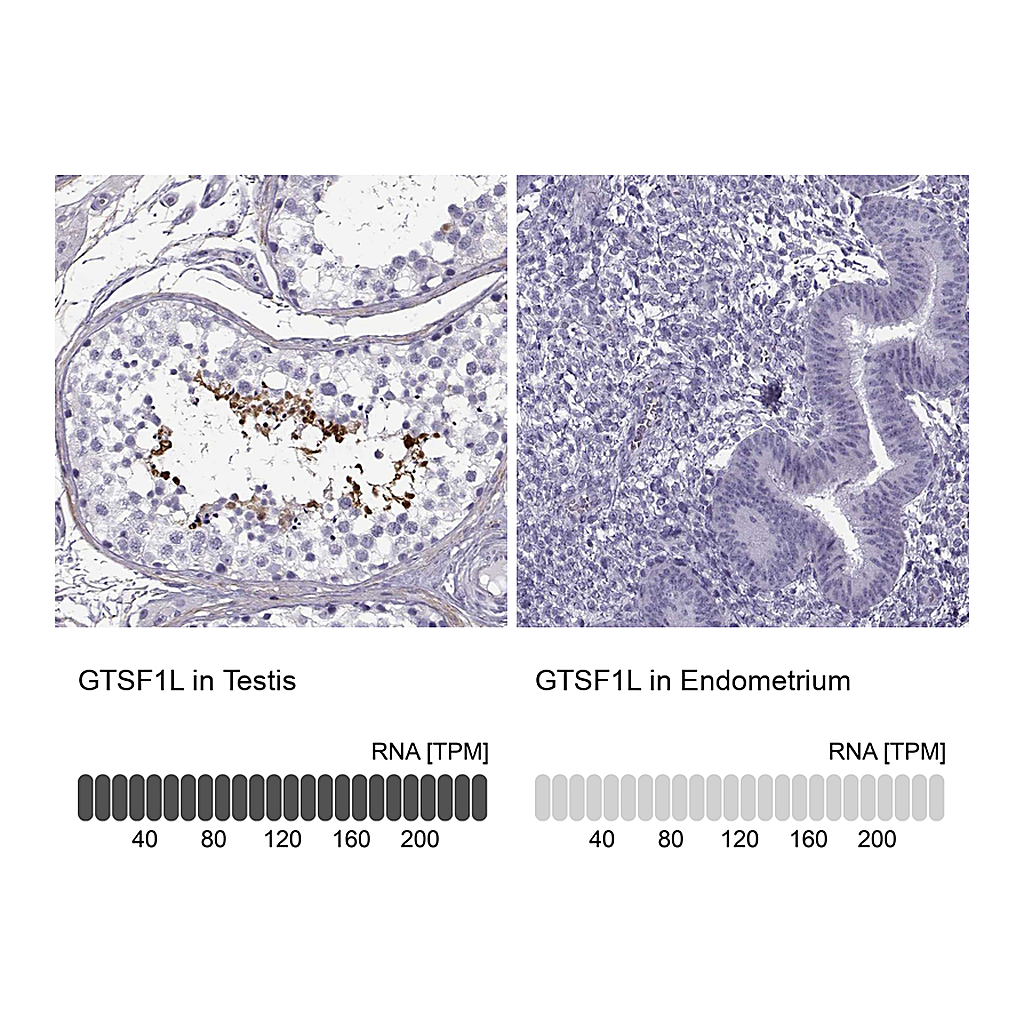 Atlas Antibodies Anti-GTSF1L Antibody