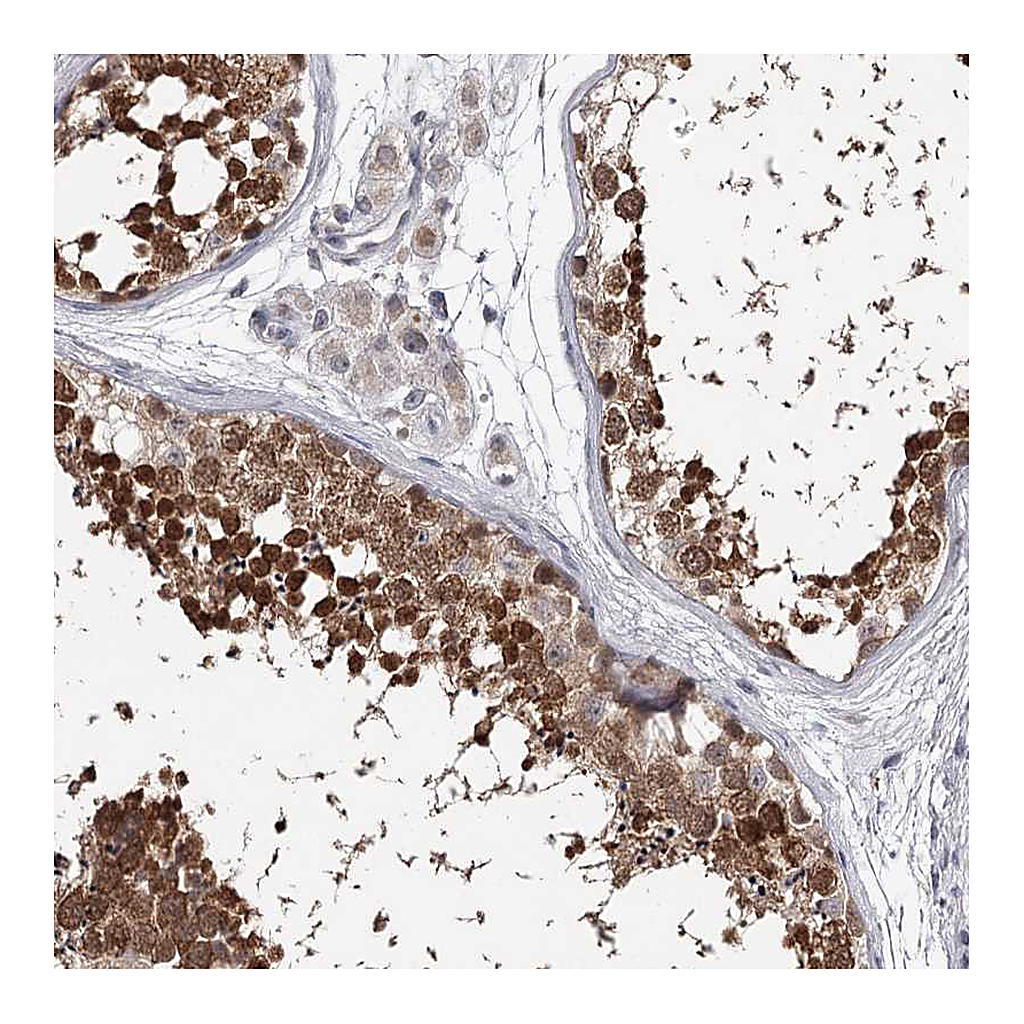 Atlas Antibodies Anti-GTSF1 Antibody