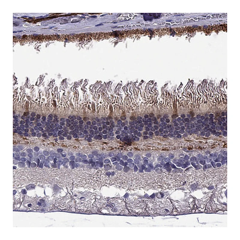 Atlas Antibodies Anti-GUCA1B Antibody