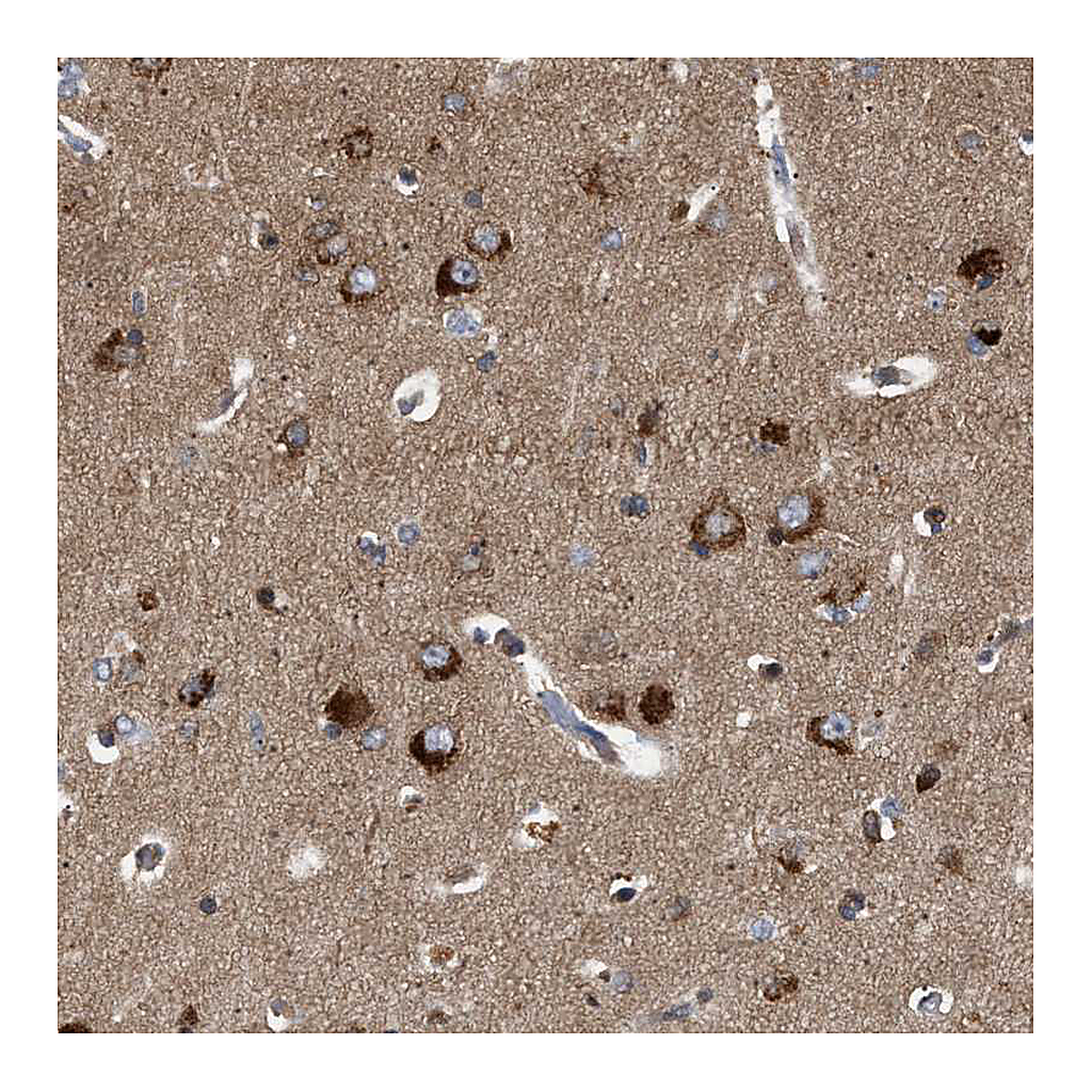 Atlas Antibodies Anti-GUCY1B3 Antibody