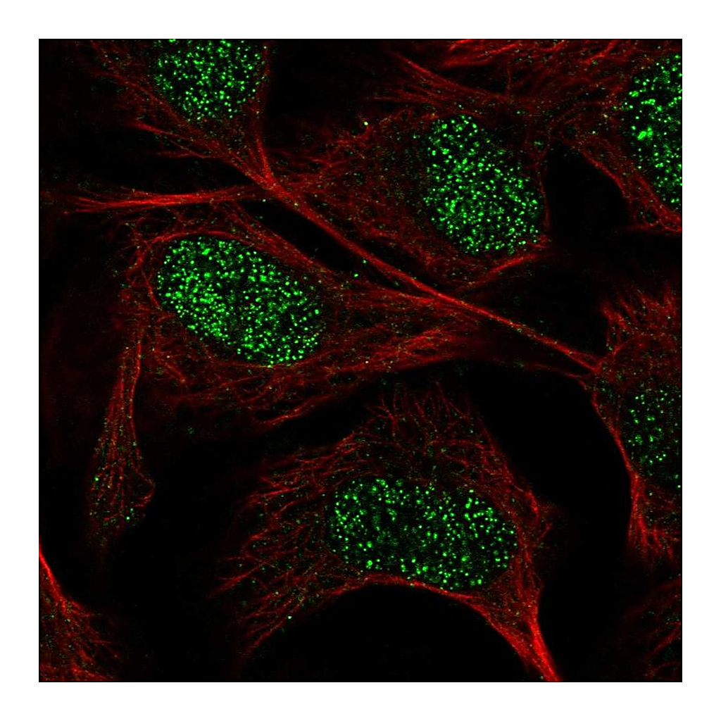 Atlas Antibodies Anti-GUCY1A3 Antibody