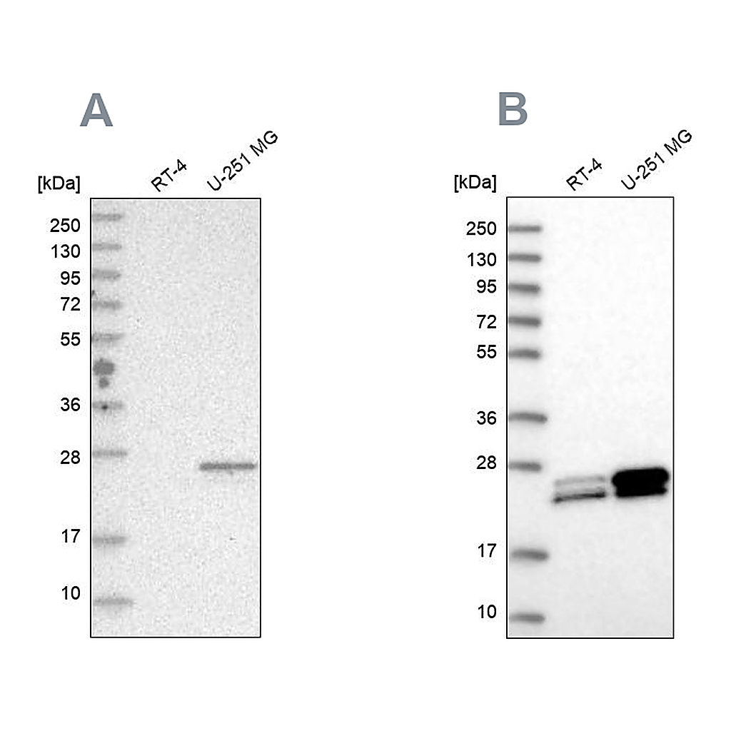 Atlas Antibodies Anti-GUK1 Antibody
