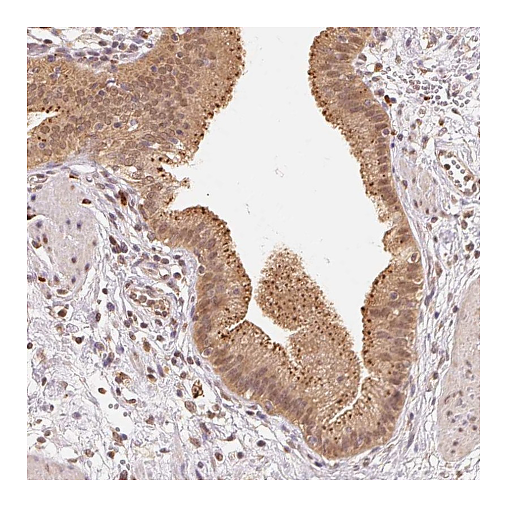 Atlas Antibodies Anti-GUSB Antibody