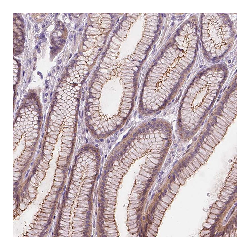 Atlas Antibodies Anti-GXYLT2 Antibody