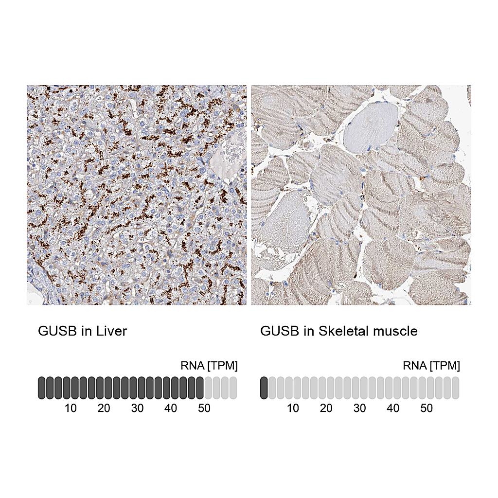 Atlas Antibodies Anti-GUSB Antibody