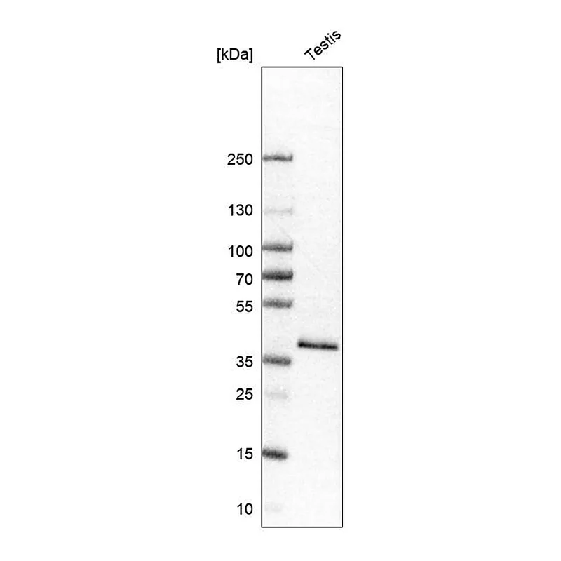 Atlas Antibodies Anti-GYG1 Antibody