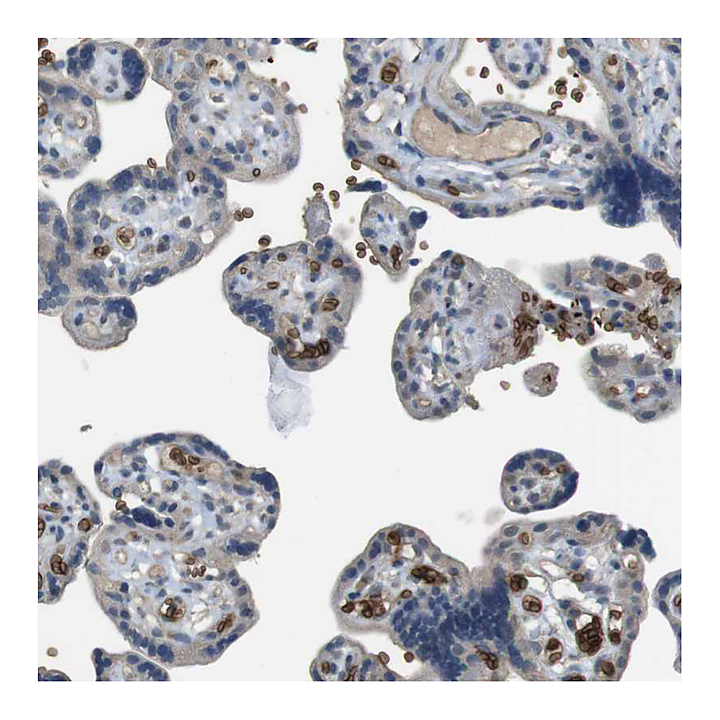 Atlas Antibodies Anti-GYPA Antibody